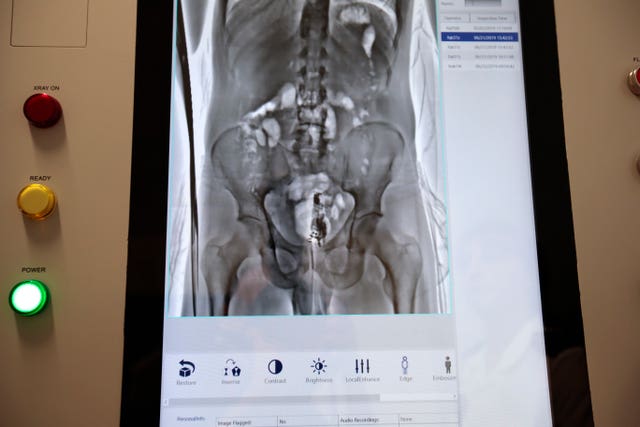 Body scanner