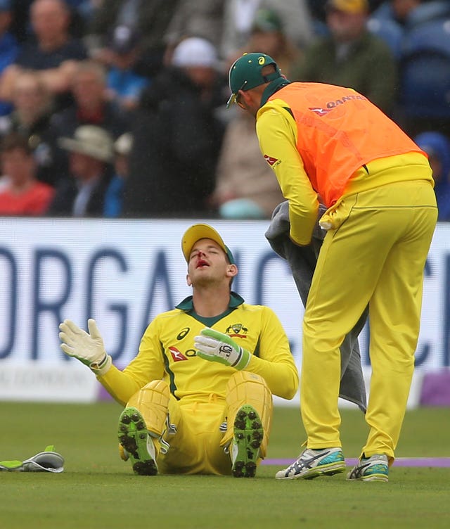 Tim Paine suffered a bloody nose in the second