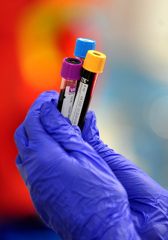 Blood samples