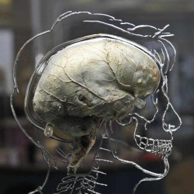 A human brain suspended in liquid with a to-scale skeleton, central nervous system and human silhouette carved into acrylic
