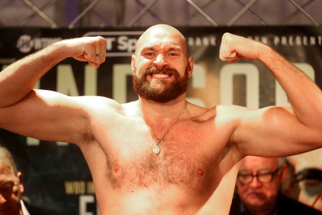 Carl Frampton and Tyson Fury Weigh-In – Europa Hotel