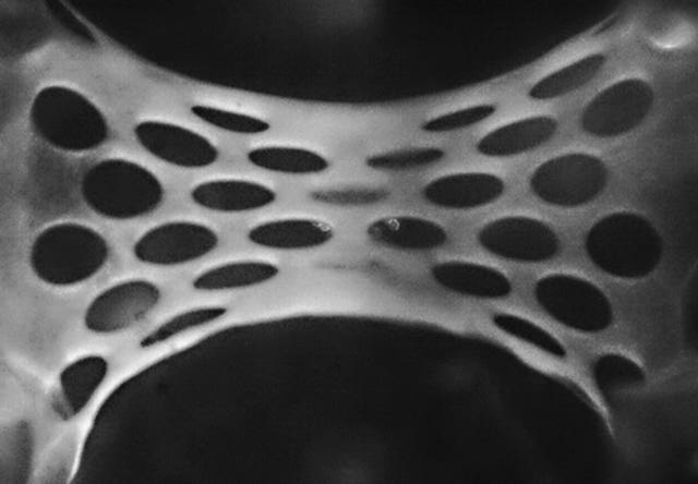 Close-up of a heart patch