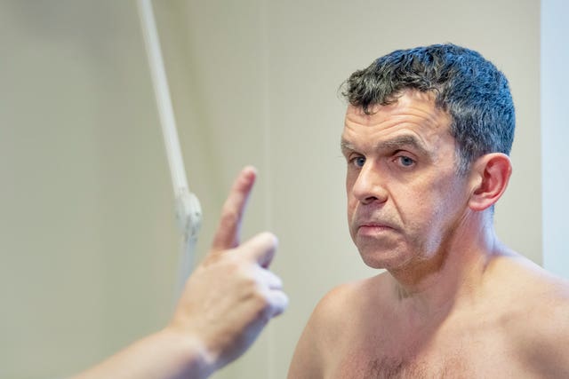 Huntington’s disease trial