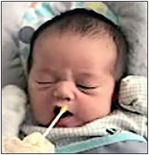 Fetal Taste Preferences Study