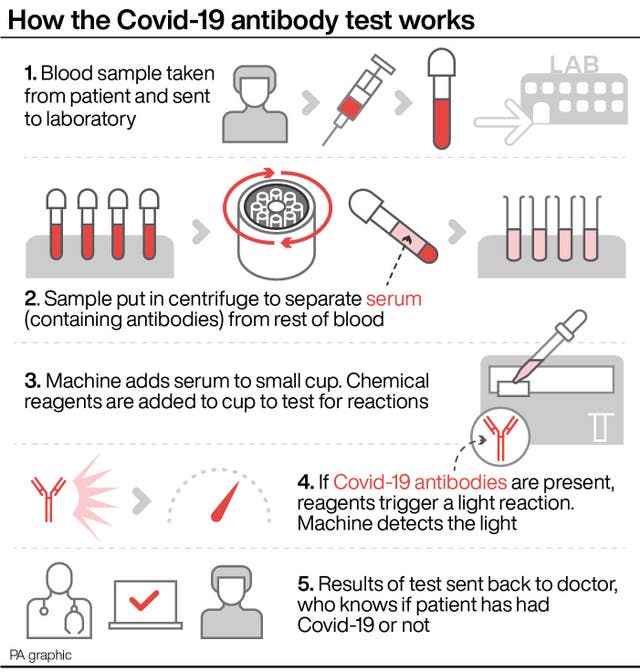 HEALTH Coronavirus Antibody QandA