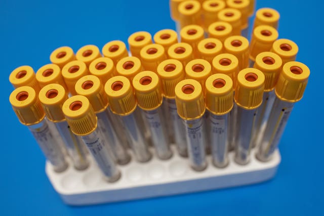 Coronavirus – Fri Jun 5, 2020