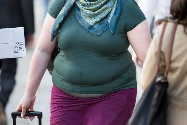 Obesity