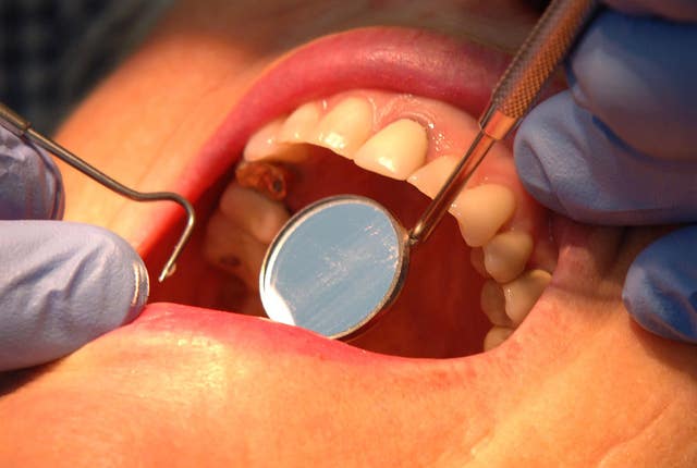Dentist checks teeth