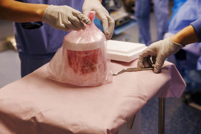 The pig kidney in a plastic container