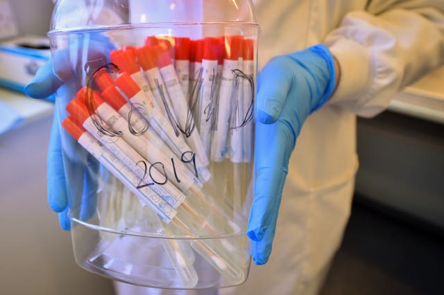 Coronavirus swabs