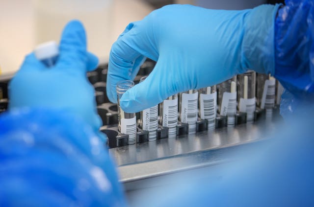 Patient samples are transferred by scientists into plates before entering the PCR process for Covid-19 testing at the Glasgow Lighthouse coronavirus testing facility (Jane Barlow/PA)