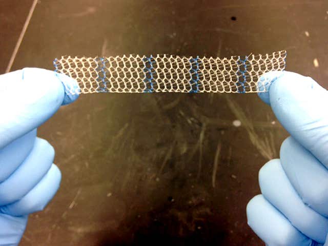 Vaginal mesh implants