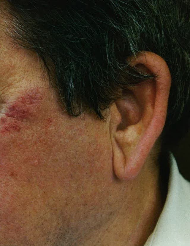 Paul Edwards injuries