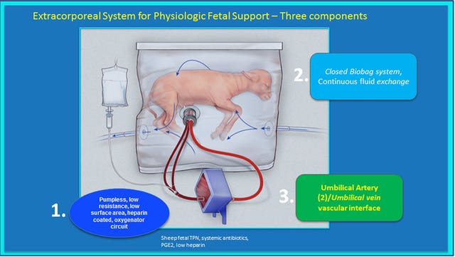 Artificial womb to keep premature babies alive – but will not replace human body