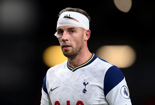 Tottenham defender Toby Alderweireld with a bandaged head