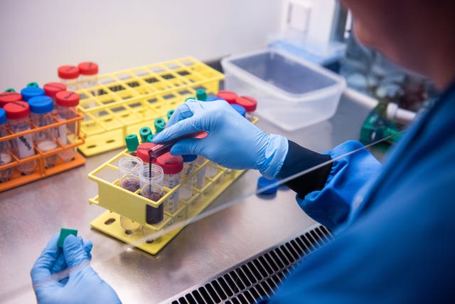 Coronavirus – Mon Nov 23, 2020