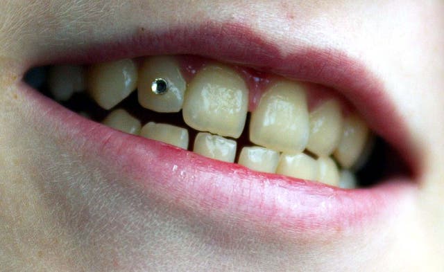 Rebecca Read Tooth Gem