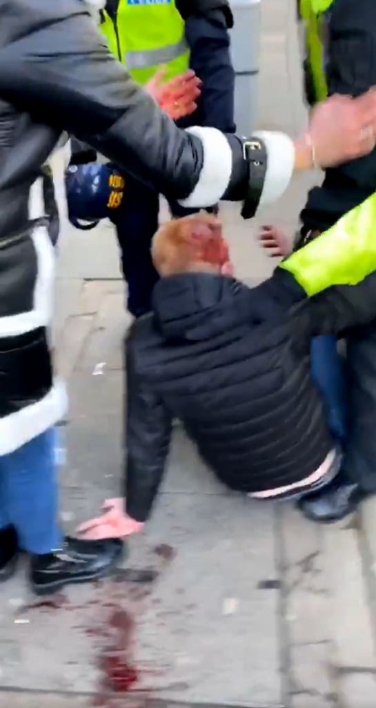 Teenager hot with police baton after football match