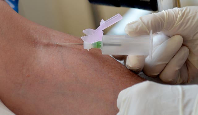 Cancer blood test