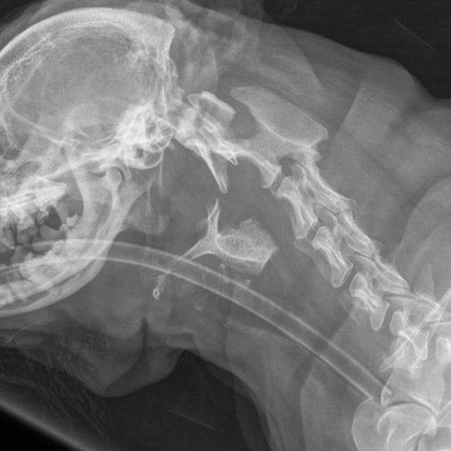 X-ray showing the bone lodged at the top of Toby's windpipe