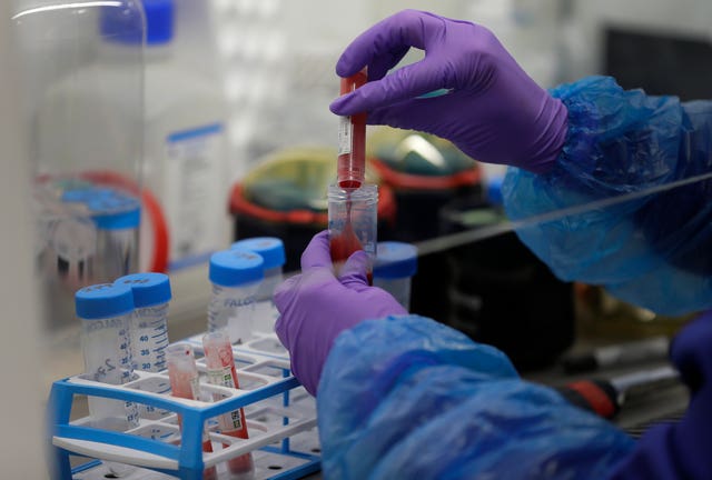 Coronavirus lab test