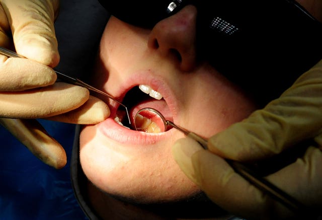 A child's teeth being looked at by a dentist