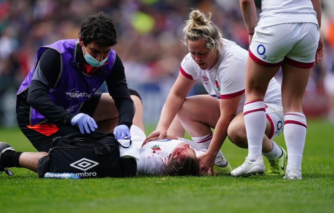 Jess Breach receives treatment for the wound to her forehead sustained at Welford Road