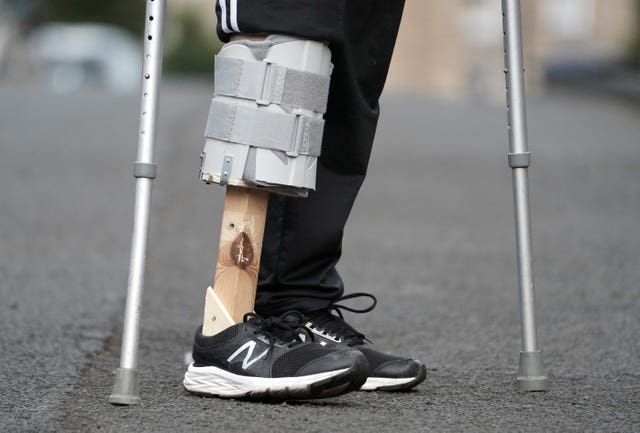Amputee Steve Watson wearing the prosthetic leg his wife Atchari made for him from items she found in the shed. Atchari Watson, 46, stepped in to action to help her husband Steve get around their house in Shotley Bridge, County Durham, after they were told he would have to wait months for one on the NHS due to the coronavirus crisis