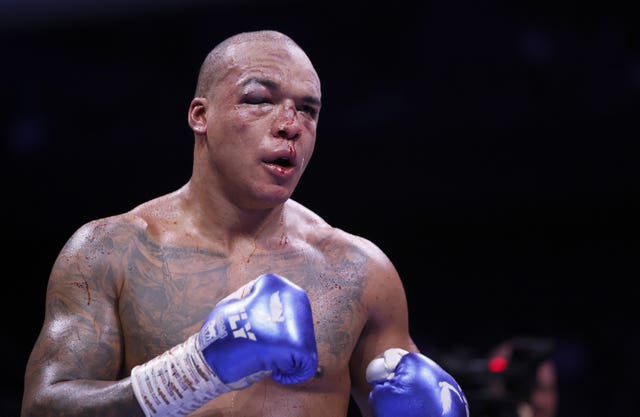 Fabio Wardley during his fight against Daniel Dubois
