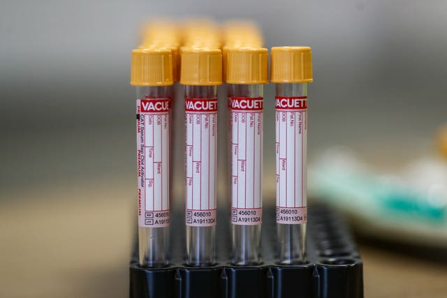 Coronavirus – Fri Jun 5, 2020
