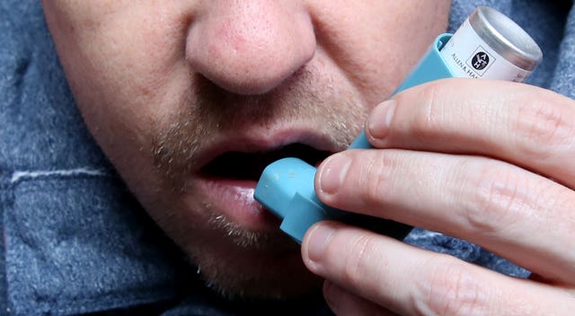 Asthma stock