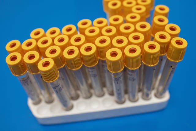 Coronavirus – Fri Jun 5, 2020
