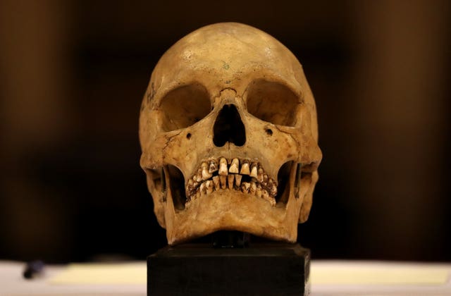 Skull