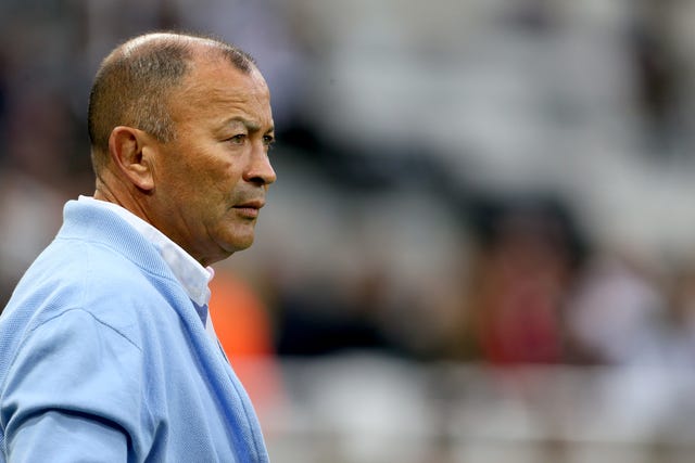 England v Italy – International Friendly – St James’ Park