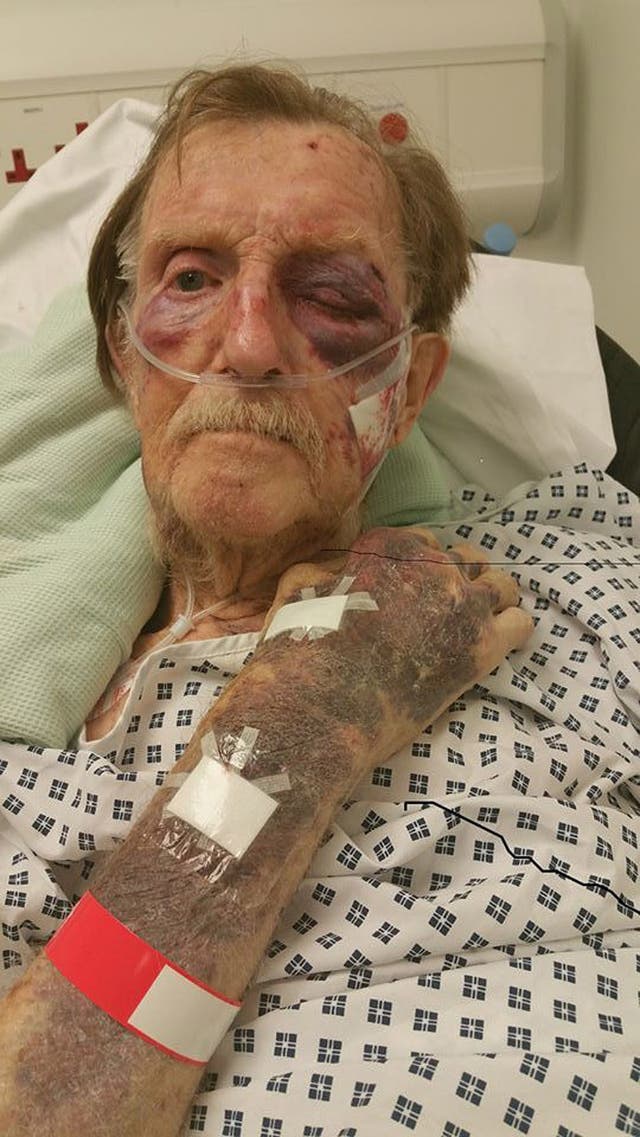 Arthur Gumbley died after suffering a badly bruised face and body when he was robbed in his own home on November 21 (Staffordshire Police/PA)