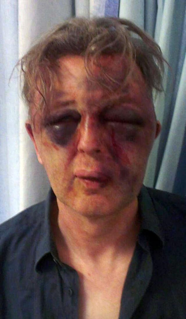 Paul Kohler was left with severe facial injuries after his beating (Metropolitan Police/PA)