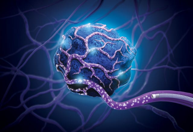 Petition for cancer treatment to be funded reaches 46,000 signatories