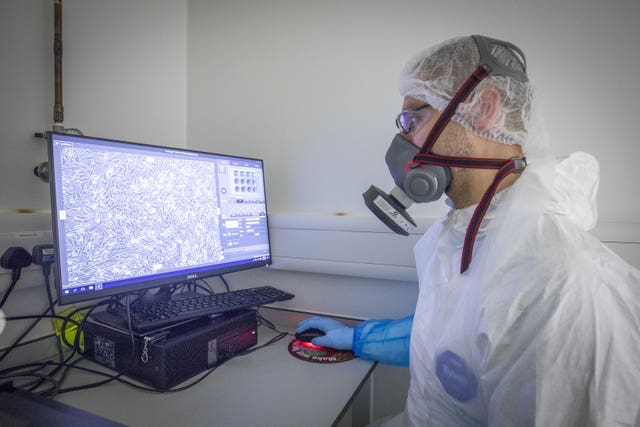 Dr Wilhelm Furnon uses a UV microscope