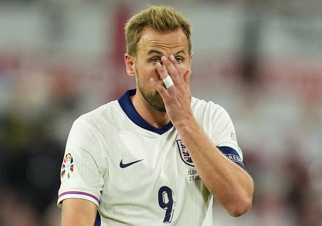 Harry Kane puts his hand to his face at the end of the Slovenia game