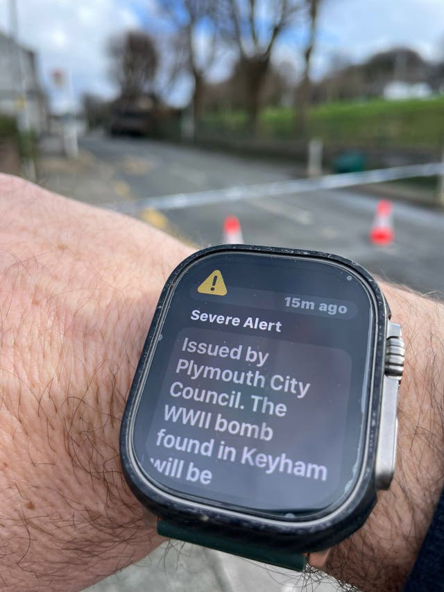 The severe alert text message appears on a smart watch