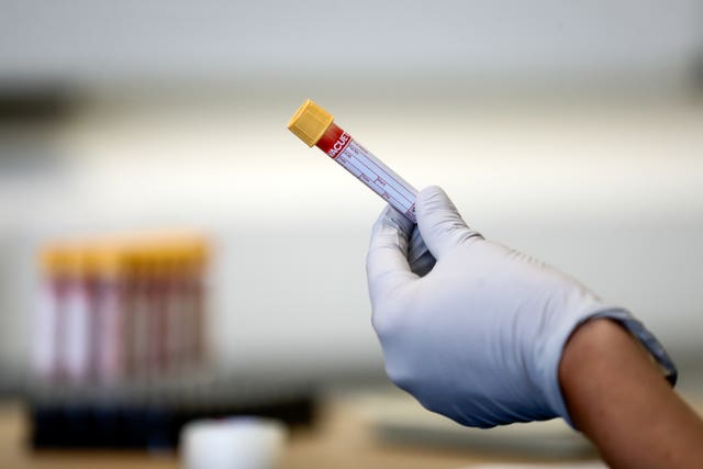 File photo dated 05/06/2020 of a test tube containing a blood sample