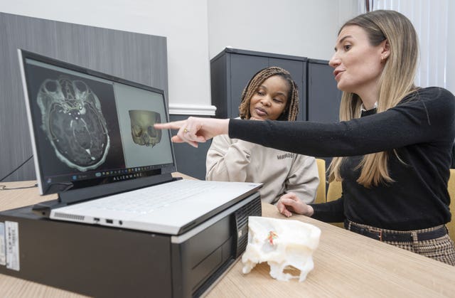 Ruvimbo Kaviya and biomedical engineer Lisa Ferrie look at an MRI scan and 3D digital model of the tumour