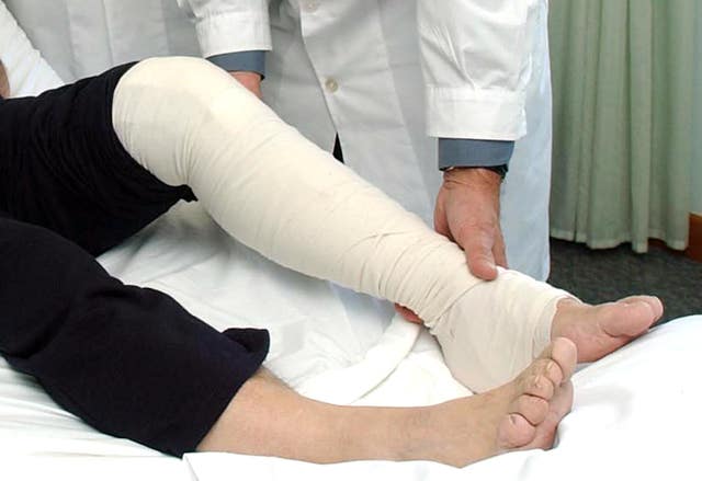 Knee replacements were found to have a long life-span (Kirsty Wigglesworth/ PA)