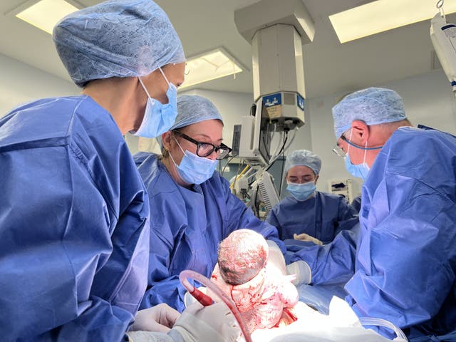 Womb transplant birth