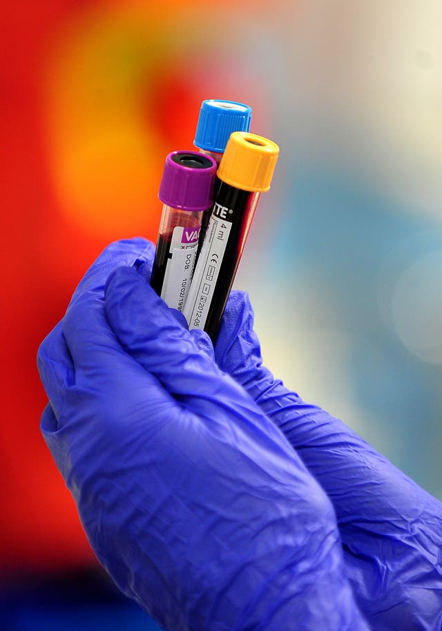 A generic stock photo of blood samples