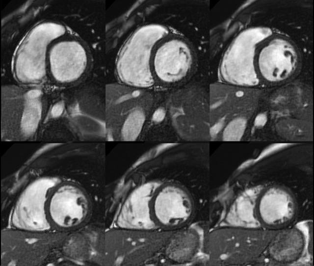 Heart scan image