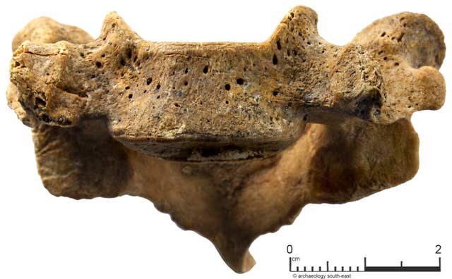 Vertebrae from the skeleton