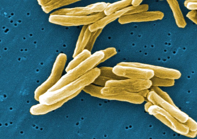 Tuberculosis discovery