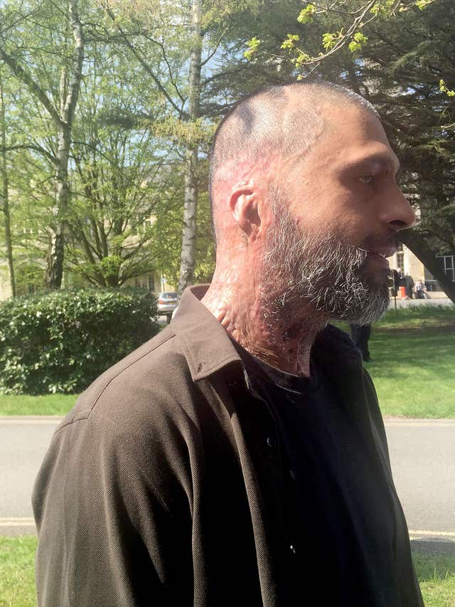 Victim Jameel Muhktar, who was doused with acid, speaks outside Snaresbrook Crown Court (Rachael Burnett/PA)
