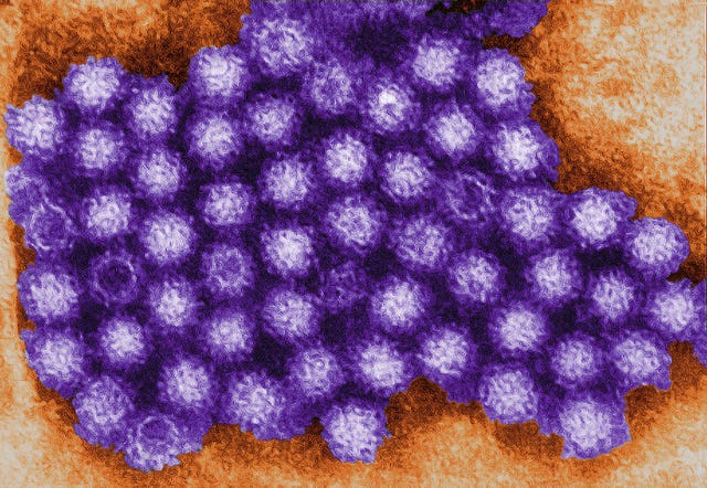 The norovirus can be harboured in seafood. (Charles D. Humphrey/Centers for/PA)